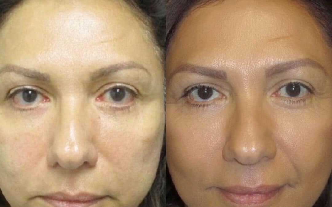 Injectable Treatments for A Youthful Appearance